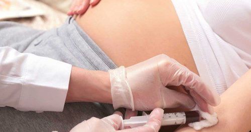 Screening test for birth defects