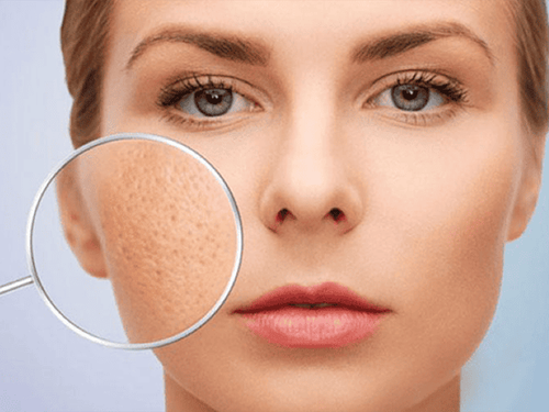 Note when taking care to tighten facial pores