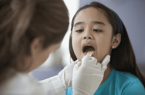 How can acute pharyngitis be transmitted? Complications of the disease and how to prevent it