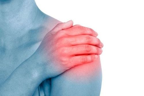 Viêm quanh khớp vai thể đông cứng gây đau nhiều, khó điều trị dứt điểm