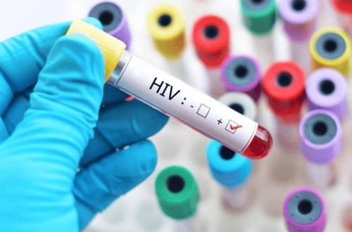 What is HIV positive?