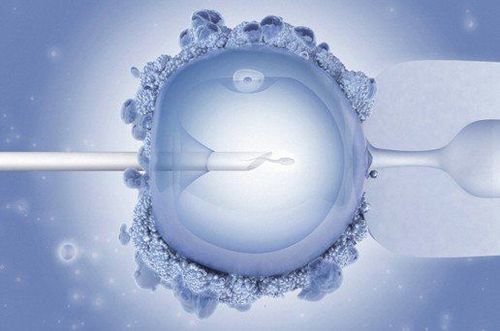 Infertility treatment: 7 questions about intracytoplasmic sperm injection (ICSI)