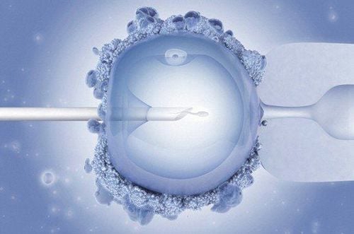 Factors affecting the results of intracytoplasmic sperm injection (ICSI)