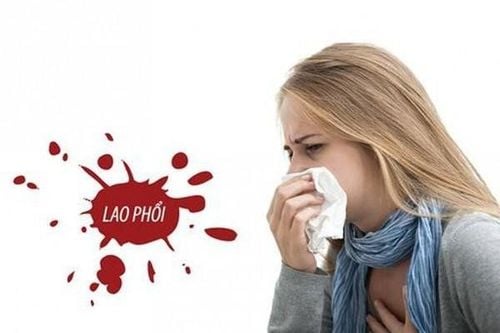 
Lao phổi là dạng thể lao phổ biến nhất, chiếm tới 80% các trường hợp bị lao
