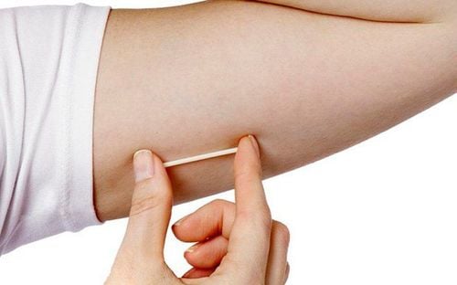 Some side effects may be encountered when implanting the contraceptive implant