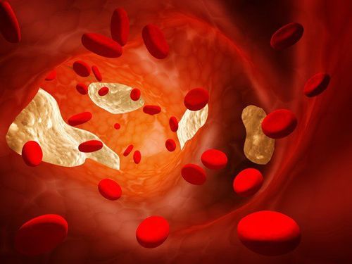 Increased blood cholesterol in patients with nephrotic syndrome