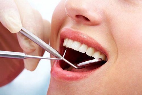 Răng mới lấy men có tẩy trắng được không?