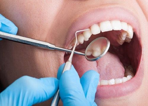 Does removing tartar have any effect on teeth?