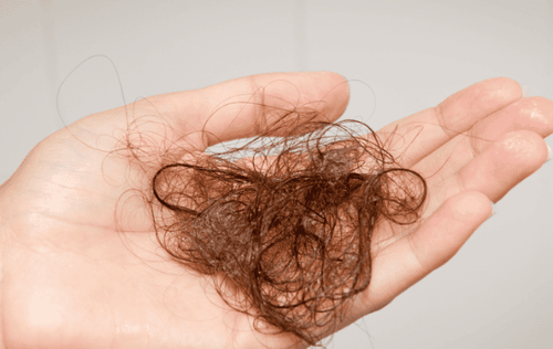 Rụng tóc nhiều: Khi nào là bệnh?