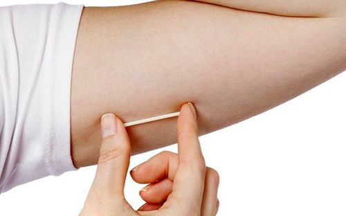 Does the contraceptive implant work right away and how long does it last?