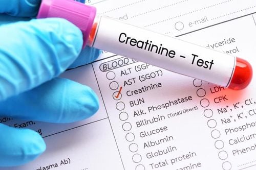 What is Creatinine Quantitative?