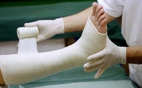 Points to pay attention to when giving first aid to people with broken bones