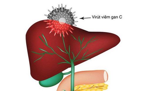 
Virus HCV trong bệnh viêm gan C
