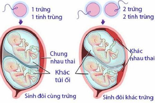 
Sinh đôi khác trứng sẽ có hai nhau thai riêng biệt cho hai thai nhi
