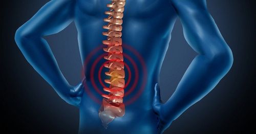 Làm thế nào để phát hiện đau rễ thần kinh thắt lưng?