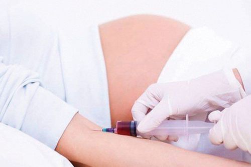 
Xét nghiệm sàng lọc trước sinh không có DNA.
