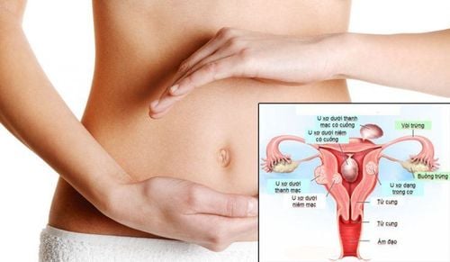 
Delayed menstruation and lower abdominal pain due to gynecological diseases
