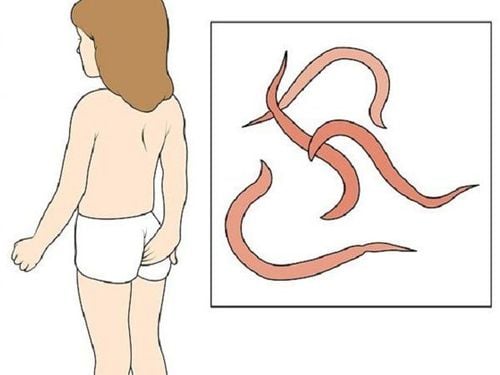 How to Identify if a Child Has Pinworm Infection?