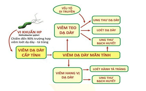 
Vi khuẩn HP gây nhiều tác hại cho sức khỏe con người
