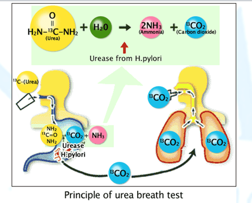 
Xét nghiệm hơi thở urê (Urea Breath Test) được sử dụng để phát hiện vi khuẩn HP trong cơ thể người
