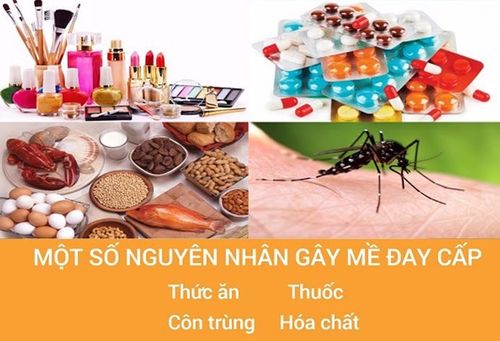 Một số nguyên nhân gây mề đay cấp.