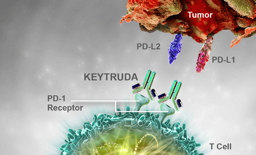 Keytruda immunotherapy - A new step in the treatment of esophageal cancer