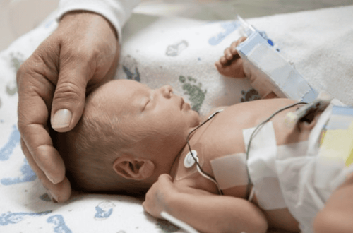 Acute respiratory failure in infants: What you need to know