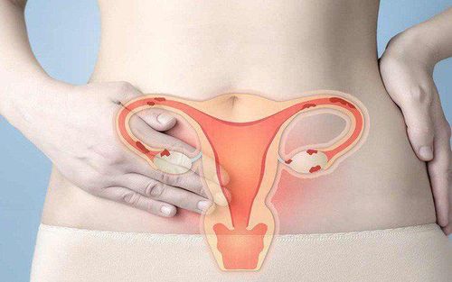 Các trường hợp cần nội soi buồng tử cung?