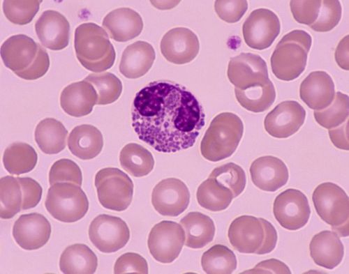 Causes of eosinophils in the esophagus