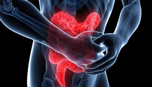 Learn about lower gastrointestinal bleeding