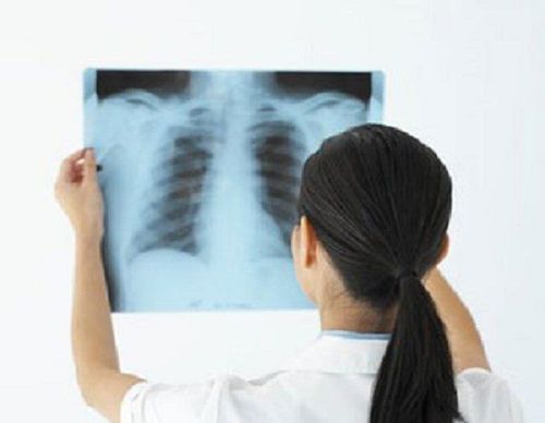 Chụp X quang có ảnh hưởng gì tới sức khỏe không?