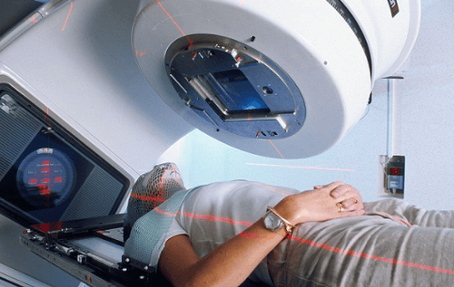 How many radiation treatments are there? Which option is reasonable?