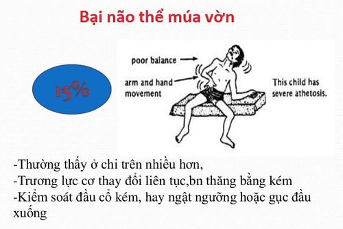 
Bại não thể múa vờn
