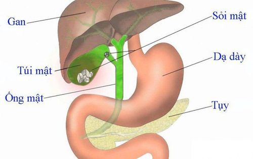 Dangerous complications of common bile duct stones