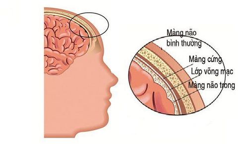 
Cấu tạo giải phẫu của màng não
