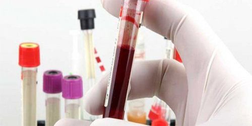 Ý nghĩa của chỉ số RDW trong xét nghiệm máu
