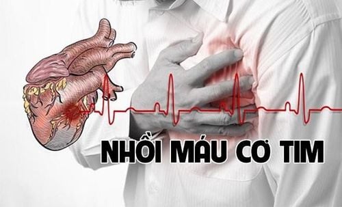 
Trường hợp bệnh nhân sốc tim do nhồi máu cơ tim có thể xuất hiện tình trạng khó thở,mệt, vã mồ hôi
