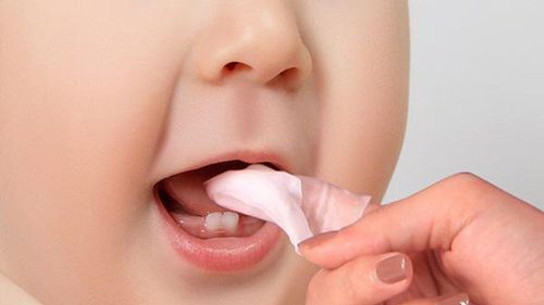 Vệ sinh miệng cho trẻ để tránh tưa lưỡi, sữa vón cục