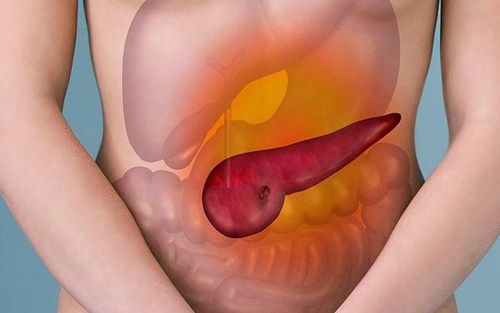 Symptoms of chronic pancreatitis