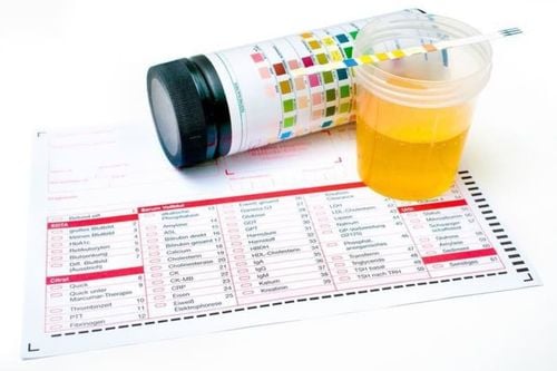 What can urine test results during pregnancy predict?