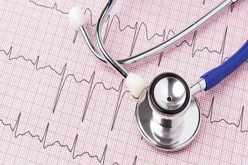 Mechanism of action of electrocardiogram