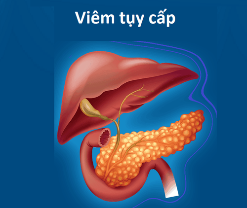 Some important laboratory indicators in the diagnosis of acute pancreatitis