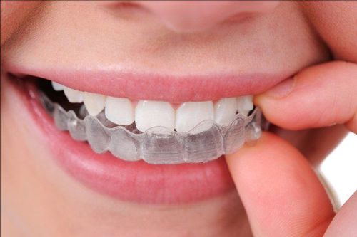 
Với khay Invisalign, bạn có thể tự mình tháo lắp tại nhà, sau mỗi 6-8 tuần, bạn sẽ tới tái khám tại nha khoa
