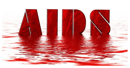 
AIDS là một căn bệnh có thể phát triển ở những người nhiễm HIV
