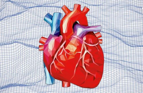 Coronary artery stenosis and blockage: Who should put a stent? Who should have surgery?