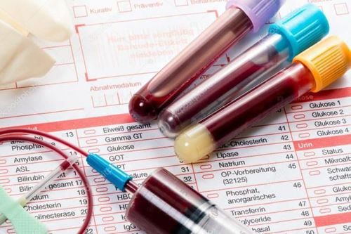 Instructions on how to read blood test results