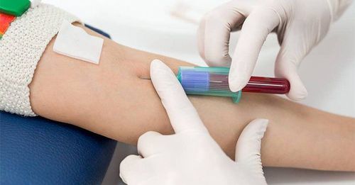 Kết quả xét nghiệm máu như thế nào là bình thường?