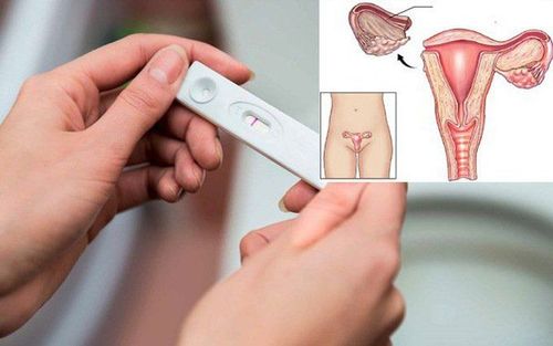 Possibility of having a baby after oophorectomy