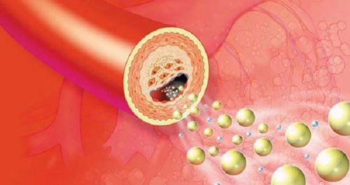 Note when treating dyslipidemia