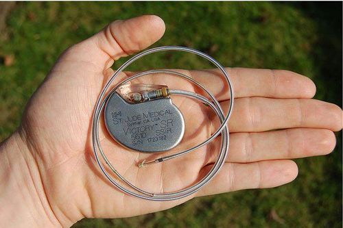 How does a pacemaker work?